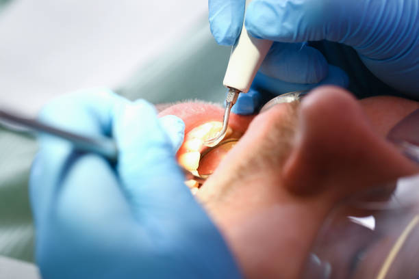 Best Pediatric Emergency Dentist in Ocean City, NJ
